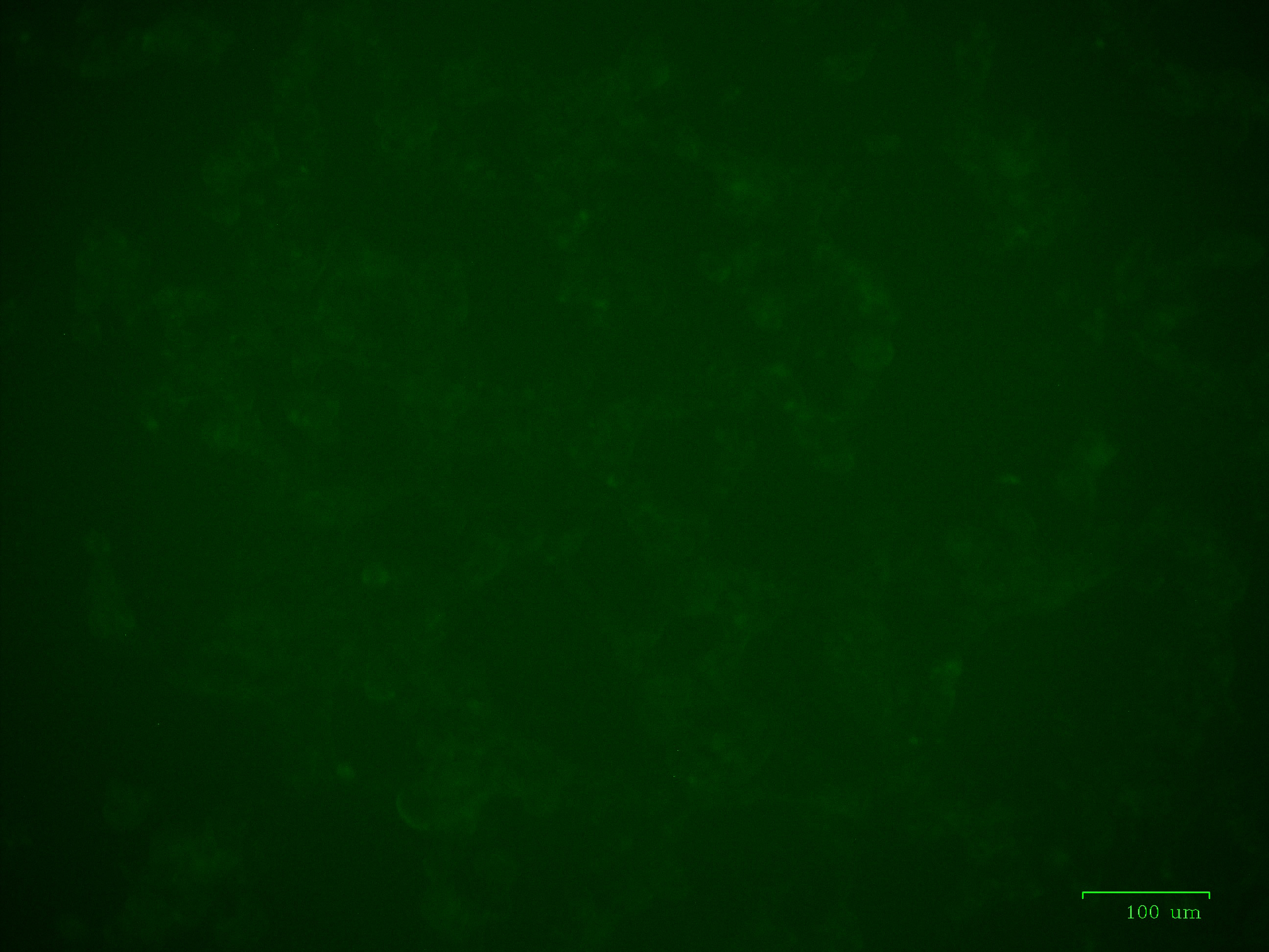 293 cells infected with Cat. No. LV661 Lenti-CMV-DIO-copGFP-SV40-Puro Vector only (i.e. absence of CRE)