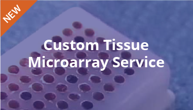 Custom Tissue Microarray Service