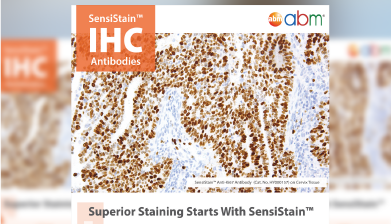 SensiStain Antibody Flyer