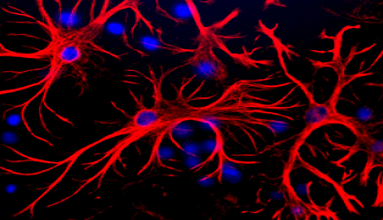 Secondary Antibodies