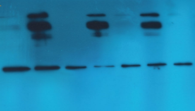 Western Blot Reagents